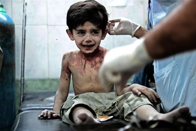 Последние слова умирающего сирийского ребенка шокировали мир
