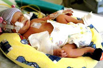 Медики спасли жизнь 275-граммового младенца