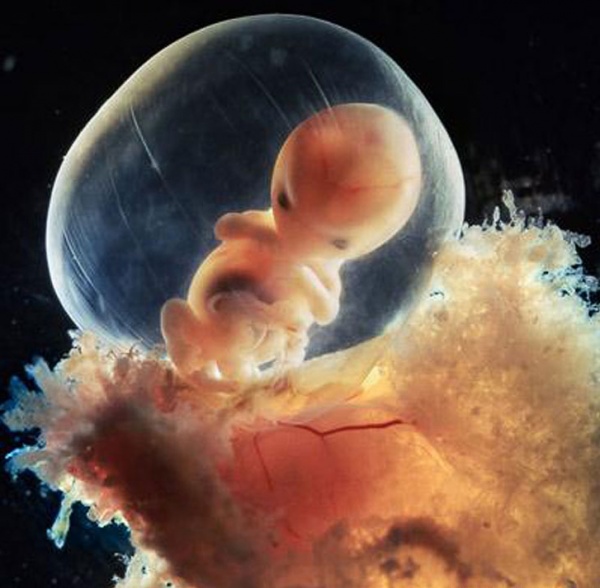 В Британии после громкого скандала запретили отапливать больницы телами эмбрионов