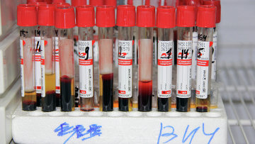 Российская вакцина от ВИЧ проходит клинические испытания