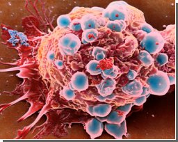 Раковые клетки маскируются под лимфатические узлы 