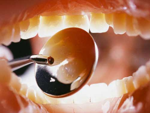 Ученые разработали способ, как лечить зубы и не сверлить их 