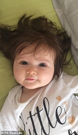Новорожденная девочка удивила необычными волосами. ФОТО