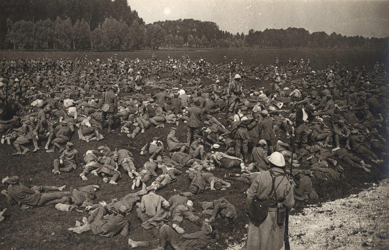 Другая сторона Первой мировой войны в фото