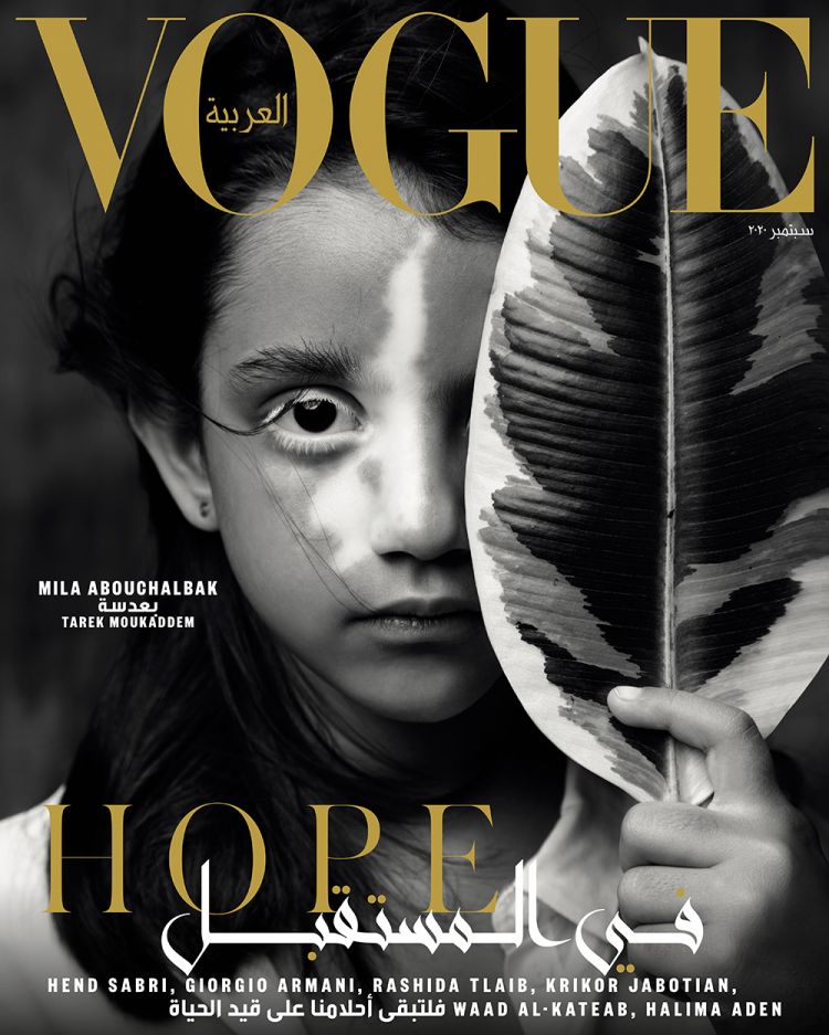 Пострадавшая от взрыва в Бейруте девочка появилась на обложке Vogue. ФОТО
