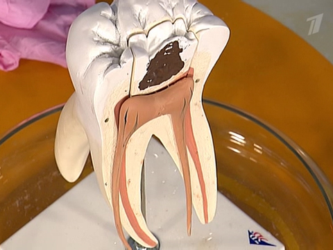 7 «плохих» продуктов, разрушающих зубы