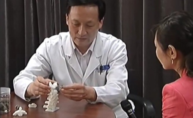 Хирурги впервые в истории пересадили нескольким пациентам 3D-напечатанные позвонки