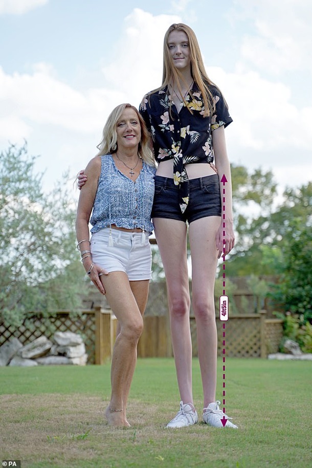 В США у девушки самые длинные ноги в мире. ВИДЕО