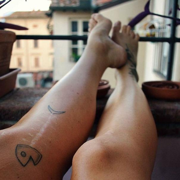 20 прекрасных татуировок, превращающих шрамы в произведения искусства (ФОТО)