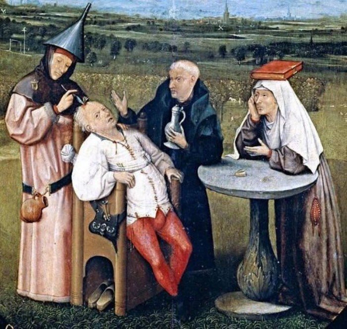 История кровопускания и его значение в медицине прошлого