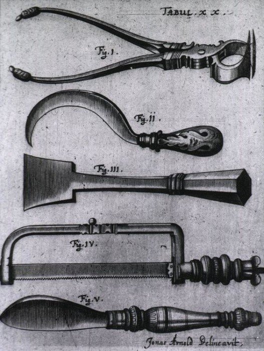 Антикварные медицинские инструменты, от одного вида которых становится плохо