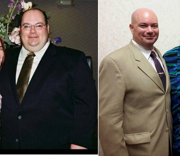 Мужчина развелся и сбросил 111 кг без диеты. ФОТО