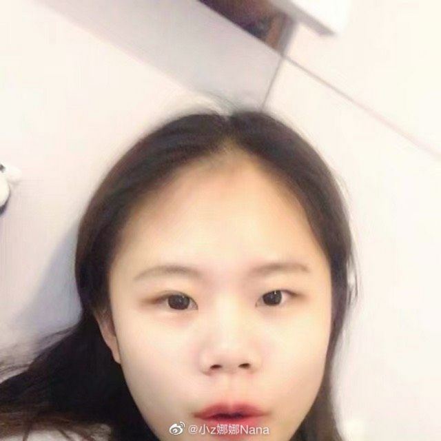 16-летняя Чжоу Чуна из Китая сделала 100 пластических операций