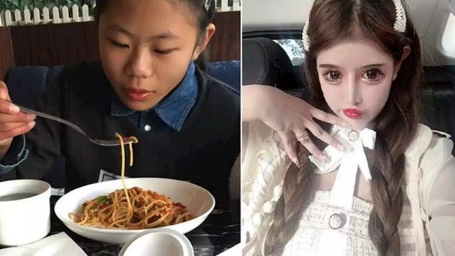 16-летняя Чжоу Чуна из Китая сделала 100 пластических операций