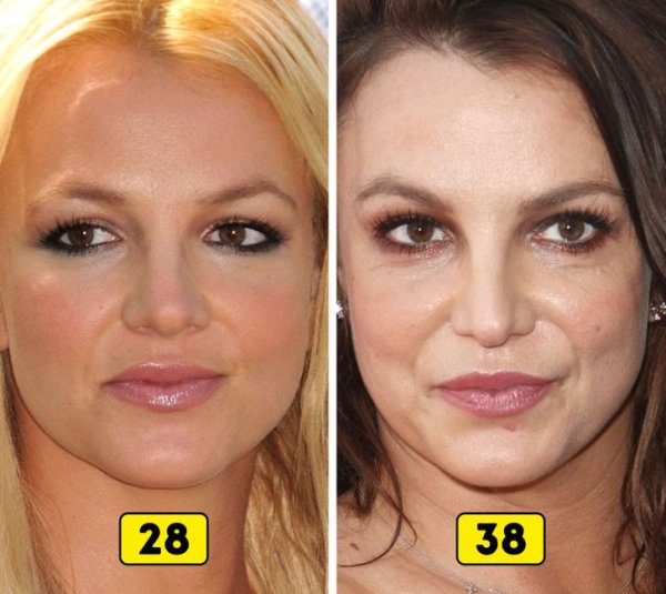 Как изменились лица всемирно известных звёзд за 10 лет