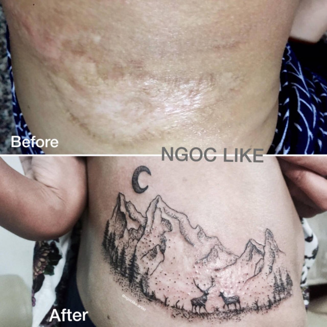 Вьетнамская тату-художница прячет шрамы людей за красивыми татуировками. ФОТО
