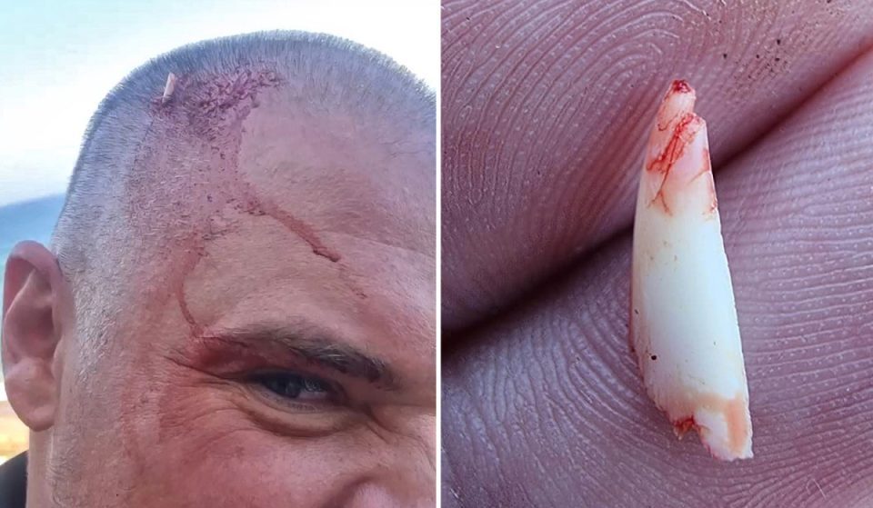 Акула сломала зуб о голову мужчины, пытаясь укусить его. ФОТО