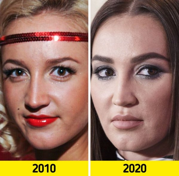 Как лица отечественных знаменитостей изменились с годами