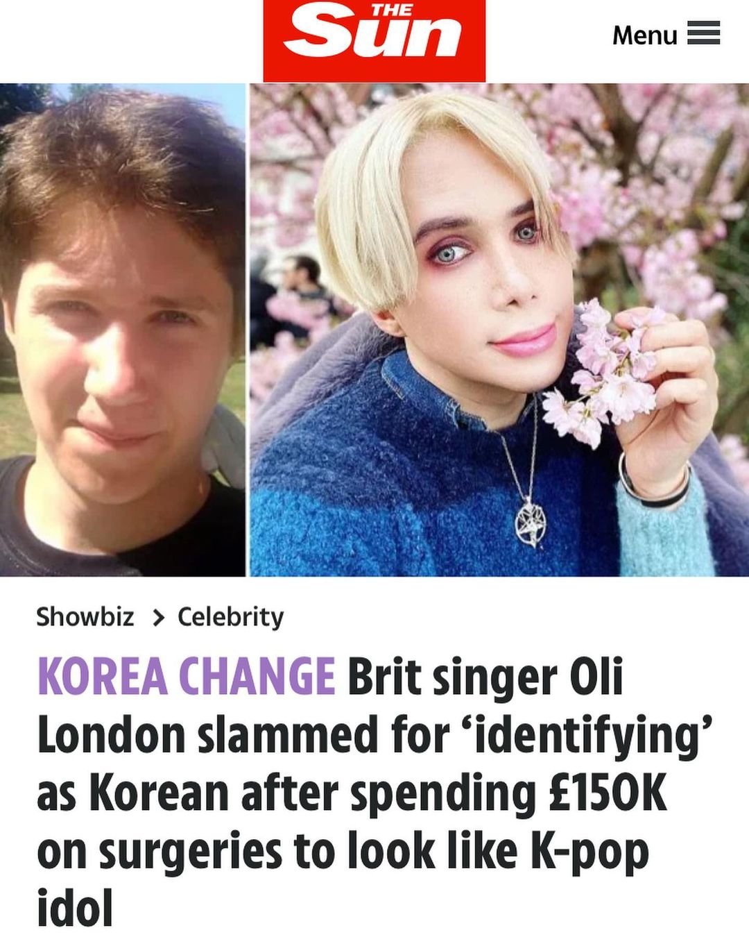 Британец сделал 18 операций, чтобы стать похожим на корейского певца, и это еще не конец (ФОТО)