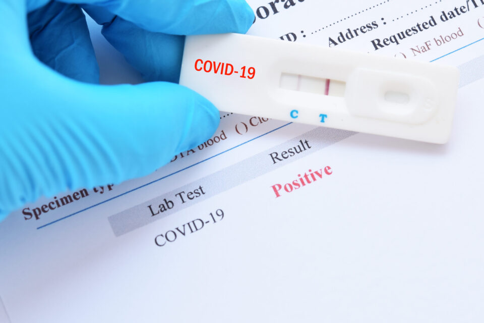 test koronavirus