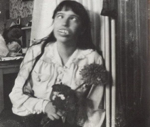 Великая княжна Анастасия Романова играет со вставными зубами, 1914г. ФОТО
