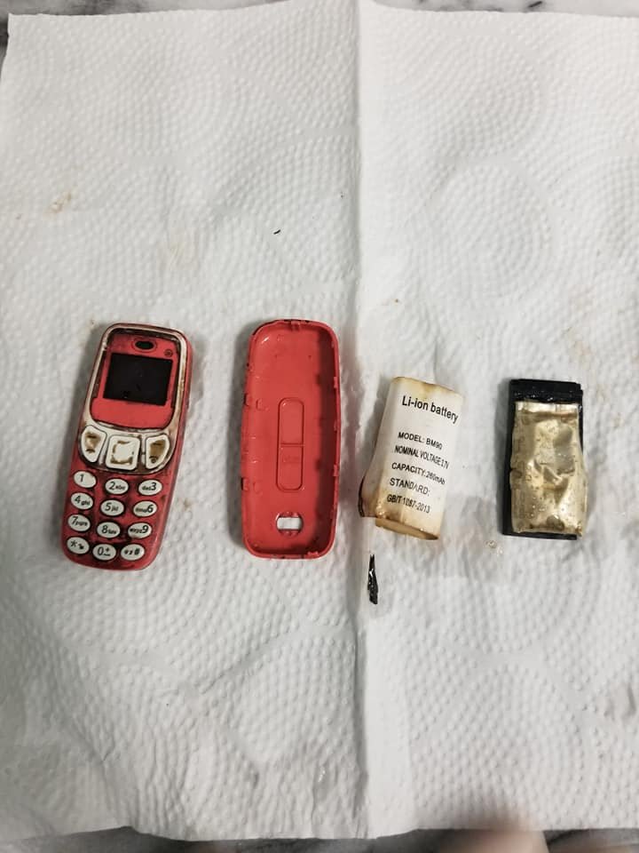 Мужчина проглотил мобильный телефон: врачи вынимали его по частям (ФОТО)