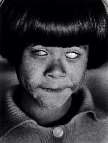 Ярче тысячи солнц: глаза, которые видели ядерный взрыв. Хиросима, 1945 г. ФОТО