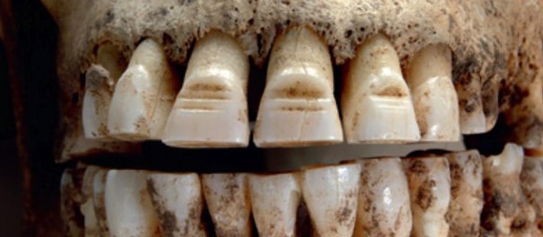 Зубы датского викинга, 972-1025 н. э. ФОТО
