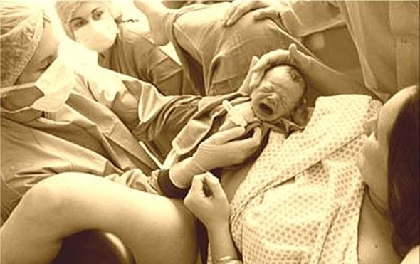 В Березанском районе хотят «сократить» родильное отделение